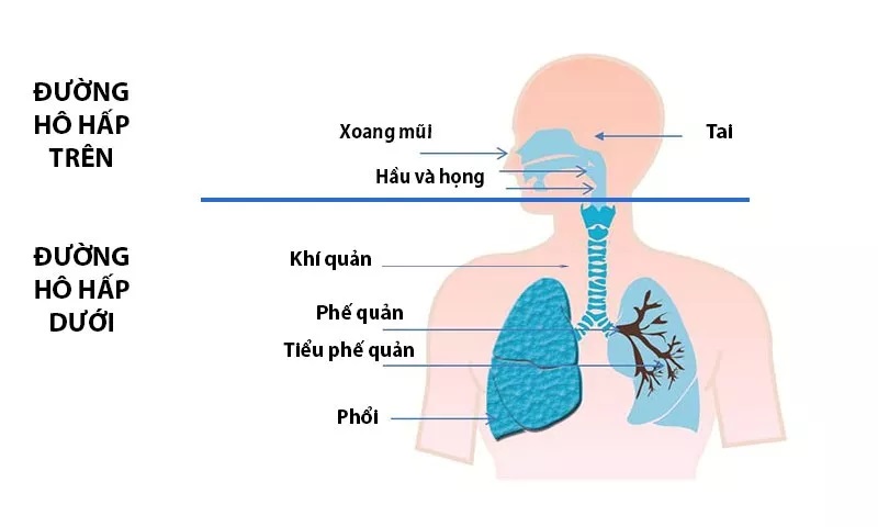 Viêm đường hô hấp trên là gì